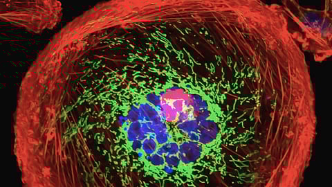 The experimental cancer drug could assist people with Rett syndrome, a rare disorder linked to autism.
(Representational Image: Unsplash)