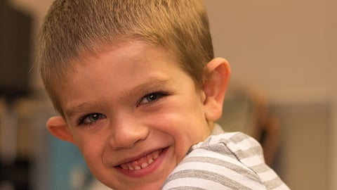 Boy With Fragile X Syndrome Smiling (Wikimedia commons)