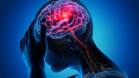 Previous research shows that migraine is linked to a higher risk of cardiovascular events such as stroke, heart disease and heart attack, but less is known about how risk factors for cardiovascular events relate to having migraine.
(Representational Image: Unsplash)