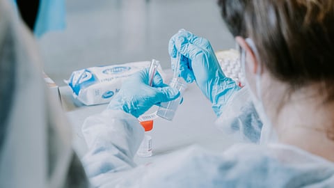 A health worker collects samples for mpox testing amid rising cases and global concern over the outbreak. (Representational Image: Unsplash)