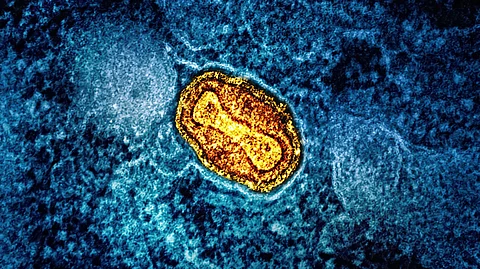 Nigeria steps up its public health response as mpox cases rise sharply across Africa, heightening concerns over the spread of the disease. (Representational Image: Unsplash)