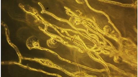 Aspergillus fumigatus hyphal tips exhibiting bursting upon exposure to Nikkomycin-loaded polymeric nanoparticles. (PIB)