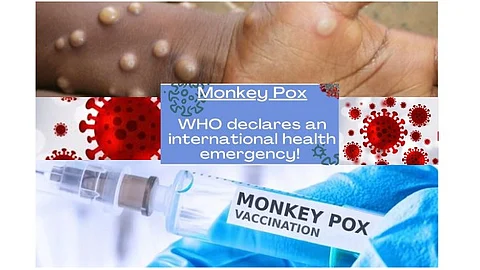 A new and highly contagious strain of pox spreading globally, Who declares public health emergency covid 19 vaccine is ineffective.