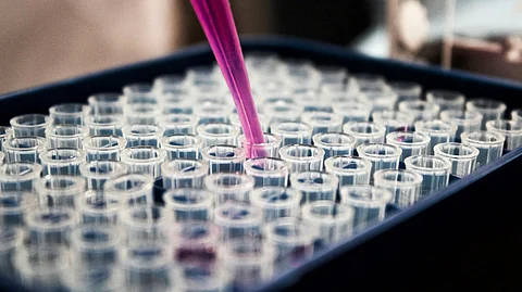 The Kit is unique in that its components have been lyophilized, allowing it to be delivered and kept at room temperature. (Representational image: Unsplash)