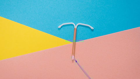 The pain people might feel when getting an IUD can be more than doctors' promises of "just a pinch. (Representational Image: Unsplash)