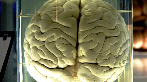 Our brains are full of electricity, billions of signals being sent each day whether we’re exercising, eating, singing, reading, working, sleeping, or just relaxing (Representational Image: Wikimedia Commons)