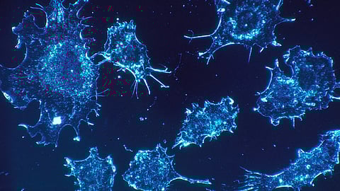 Millennials face rising cancer rates, driven by modern environmental and lifestyle factors.(Wikimedia commons)