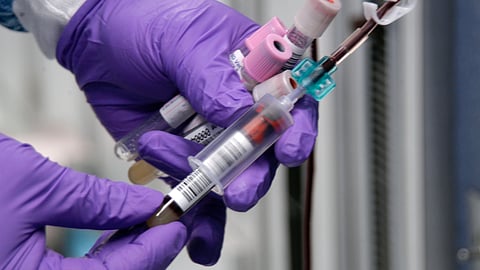 A groundbreaking study highlights how a simple blood test can predict cardiovascular outcomes in women over 30 years. (Wikimedia Commons - PH3 Jeremy L. Grisham, USN)