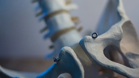 Abnormal bone growth refers to the formation of bone tissue in areas where it shouldn’t normally occur, or the excessive growth of bone in typical skeletal regions. (Representational image: Unsplash)