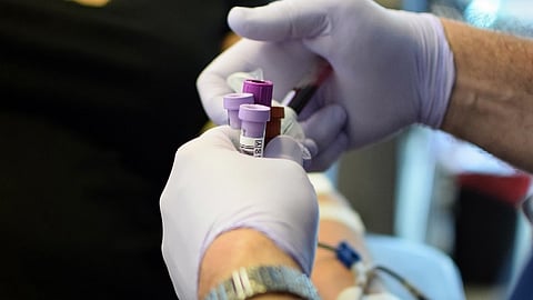 Scientists solve a 30-year-old mystery by discovering the genetic cause of the rare AnWj blood group, offering life-saving insights for transfusion medicine. (Wikimedia Commons)