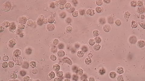 As we age, our cells wear out. It's called cellular senescence, a state of irreversible cell cycle arrest and it's increasingly recognized as a key contributor to aging (Representational Image-Wikimedia Commons)