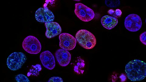 Gallium has antimicrobial properties, making gallium-doped glasses effective against bacterial infections. This is particularly useful in implant coatings to prevent post-surgical infections, especially in bone implants.(Representational image: Unsplash)