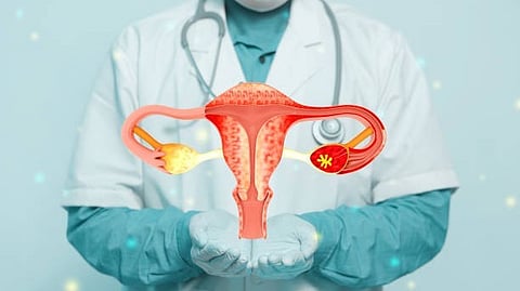 Most women are diagnosed late in the course of the disease when survival rates are much lower (Representational Image: Unsplash)