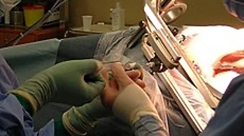 A 24-year-old’s severed hand was successfully reattached in a nine-hour surgery by RML Hospital’s skilled team. (Representational image: Wikimedia Commons)