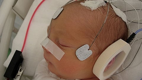 NICU infants are at elevated risk for hearing loss. (Representational Image: Wikimedia Commons)