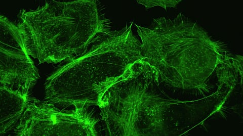 This alteration may be linked to a more-aggressive form of the prostate cancer disease (Unsplash)