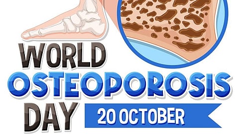 Osteoporosis can make bones seem strong on the outside but fragile on the inside (Image from Freepik)