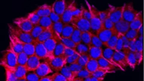 CAR-T cells express synthetic receptors that detect specific molecular markers, or antigens, on cancer cells using an antibody fragment as an external sensor. (Unsplash)