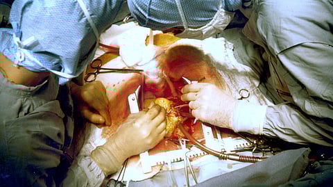 Black patients who have coronary bypass surgery experience higher rates of severe postoperative complications, including death and cardiac arrest. (Wikimedia Commons)