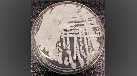 C. auris, which emerged in New York City in 2016, is a fungus that can cause serious bloodstream, wound, and ear infections. (Wikimedia Commons)