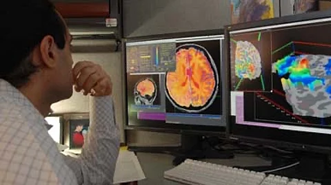 New research links gut microbes to daily stress regulation, opening doors to microbiome-based mental health therapies. (Representational Image-Wikimedia Commons)