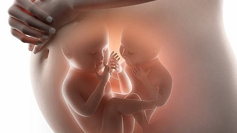 Twins faced numerous health risks, including breathing difficulties (Representational Image: Unsplash)