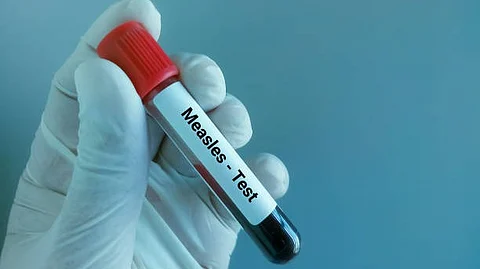 A person holding a vial of blood.
