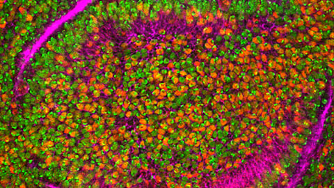 Hepatitis A virus is highly contagious virus. (UNSPLASH)