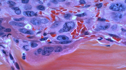 Study to Identify Risk of Pancreatic Cancer in Vulnerable Group.
(CDC UNSPLASH)