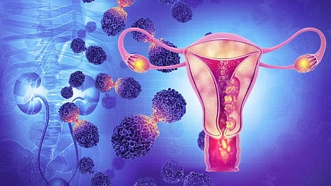 Often patients with these cancers are prescribed chemotherapeutics, but sometimes this strategy stops working (Representational Image: Unsplash)