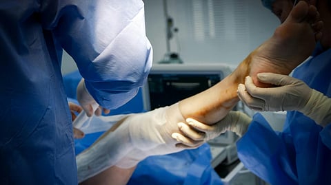 Challenging the NCDRC order, the surgeon, in his plea before the Supreme Court, claimed that the patient also had an injury in the left leg for which he was advised surgery. (Representational image from Pexels.com)