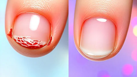 Proper nail care starts with your cuticles. Avoid common mistakes that can lead to infections, slow growth, and painful damage (Freepik)