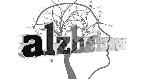 Alzheimer's disease, a progressive condition that impairs memory, thinking, and everyday function, is typically associated with aging, though some cases occur earlier. (Pixabay)