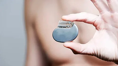 Dual chamber leadless pacemakers help regulate the heart’s rhythm by stimulating the heart’s upper (atrial) and lower (ventricular) chambers. (Unsplash)
