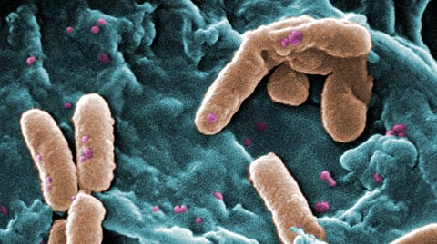 Pseudomonas aeruginosa bacteria infected with Pf bacteriophage, a key factor in accelerated lung function decline in cystic fibrosis patients.