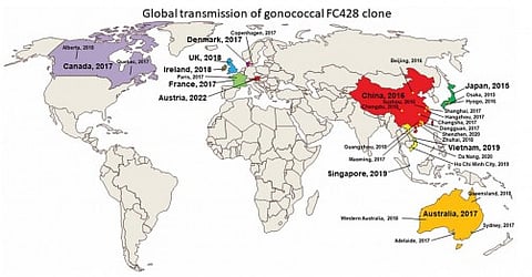 The FC428 clone of Neisseria gonorrhoeae, identified in Japan in 2015, rapidly expanded across continents, affecting countries in Asia, Europe, and North America. (Image: Infectious Microbes & Diseases)