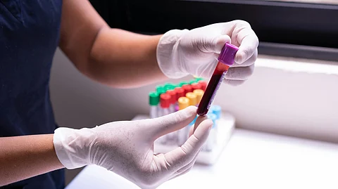 The country confirms its first elderly HMPV case in Ahmedabad, Gujarat on Thursday, after an 80-year-old man tested positive (Representational Image: Pexels)