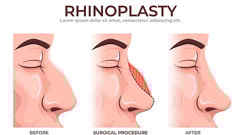 Unlike beauty surgeons, who only care about how things look, ENT doctors care about how things look and work. (Freepik)