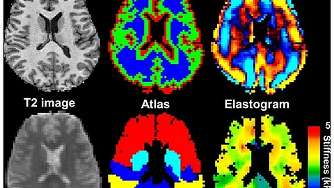 AI visualizes the hidden narratives of our dreams, bridging science and the subconscious. (Representational image)