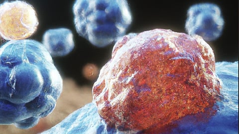 The experimental approach, which uses tiny capsules called small extracellular vesicles (sEVs), could offer an innovative new type of anticancer immunotherapy treatment. (Representational image: Wikimedia Commons)