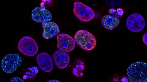 Extracellular vesicles contain an ion channel – a protein that opens a corridor allowing electrical charges to pass through the protective outer membrane, a necessary step to keep contents and conditions stable inside