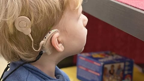 The auditory brainstem implant surgery is critical for children between the ages of one to three, who are born deaf