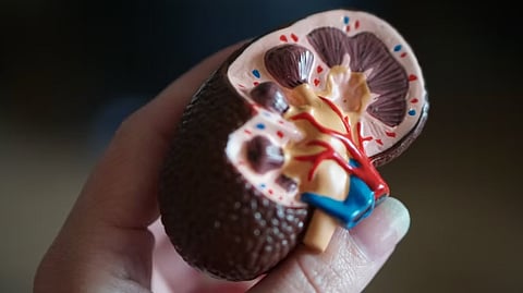 The patient, who had been living with autosomal dominant polycystic kidney disease (ADPKD), presented with severe abdominal pain and blood in his urine.