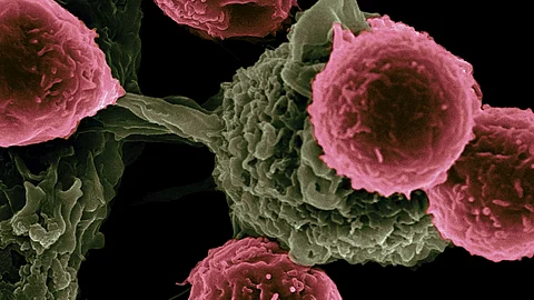 PET scan tool to detect cancer inflammation cells. (Unsplash)