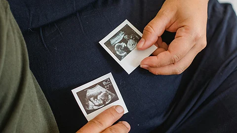 McMaster University's study reveals that both THC and CBD impair fetal growth during pregnancy.