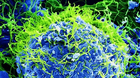 Uganda discharged the last eight patients who recovered from Ebola on 20th Feb 2025.