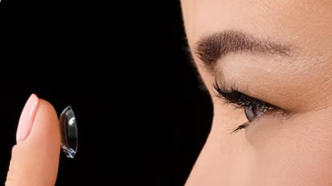 The lenses had migrated over the years without causing noticeable discomfort.