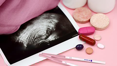 SMA is caused by a lack of survival motor neuron protein.