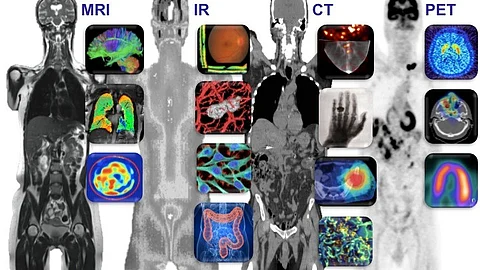 Medical imaging scans (MRI, CT, PET) illustrating cancer diagnostics, highlighting the urgent need for targeted interventions in India's escalating cancer crisis among women.