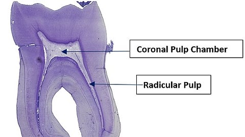 The pulp at the center of your tooth contains vital nerves and blood vessels that keep the tooth alive and healthy.